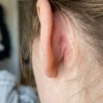 Skrytý signál z těla aneb proč byste právě teď měli kontrolovat oblast za ušními boltci skryty-signal-z-tela-aneb-proc-byste-prave-ted-meli.webp.webp